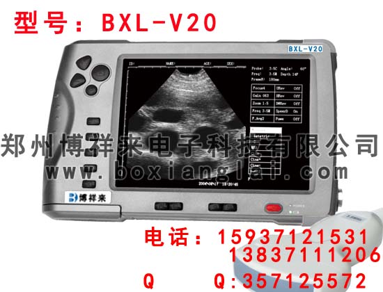 BSңyʽBֳʽB